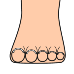 よくある外反母趾のセルフケア「足指のグーパー運動の弊害」
